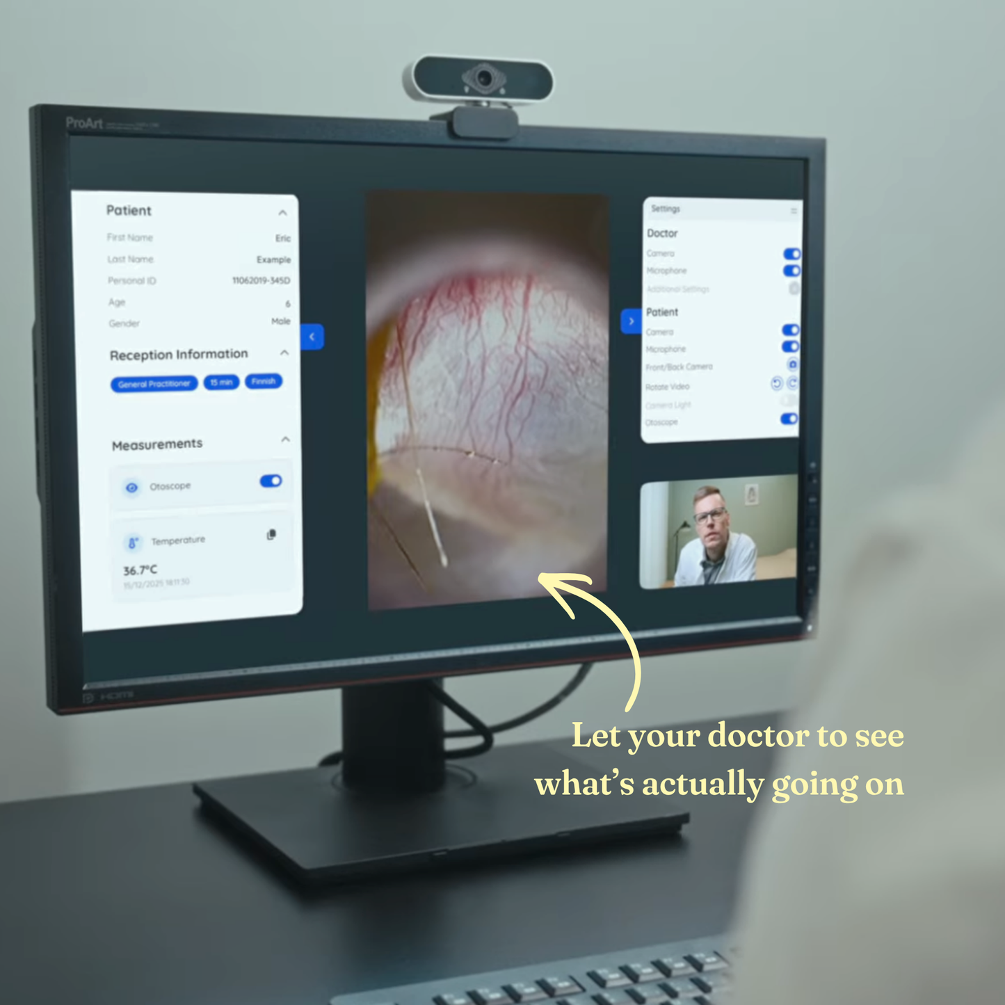 Digitaalinen otoskooppi